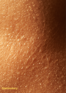 uneven textured skin with visible pores on cheeks and blended cream blush application